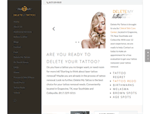 Tablet Screenshot of deletemytattoo.com